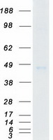 Coomassie blue staining of purified CSNK1G3 protein