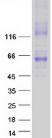 Coomassie blue staining of purified SLC30A1 protein