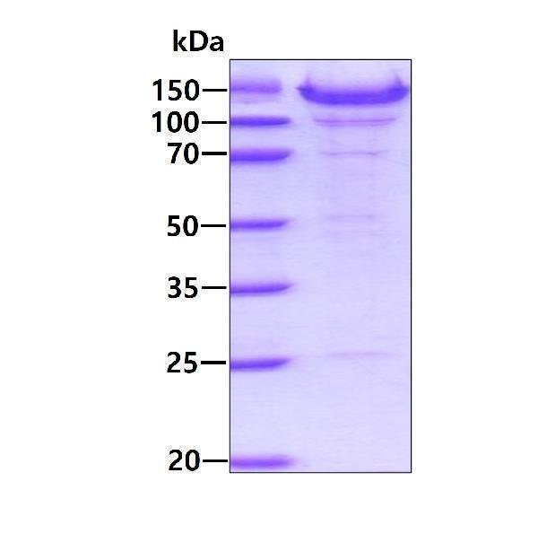 3ug by SDS-PAGE under reducing condition and visualized by coomassie blue stain