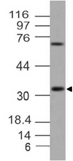 rawlysate