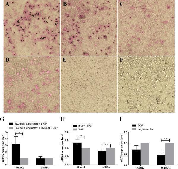 The influence of TNFα expressed by BV2 cells for VSMC calcification
