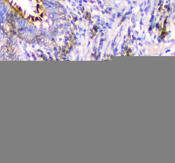 rp1002 ifn gamma primary antibodies ihc testing 2