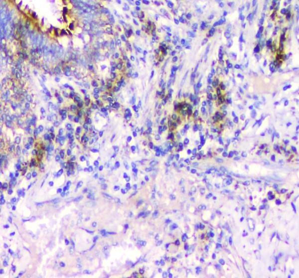 rp1002 ifn gamma primary antibodies ihc testing 2_1