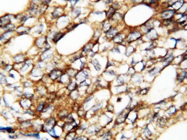 rp1005 2 ihc anti fgf1 fgf acidic antibody