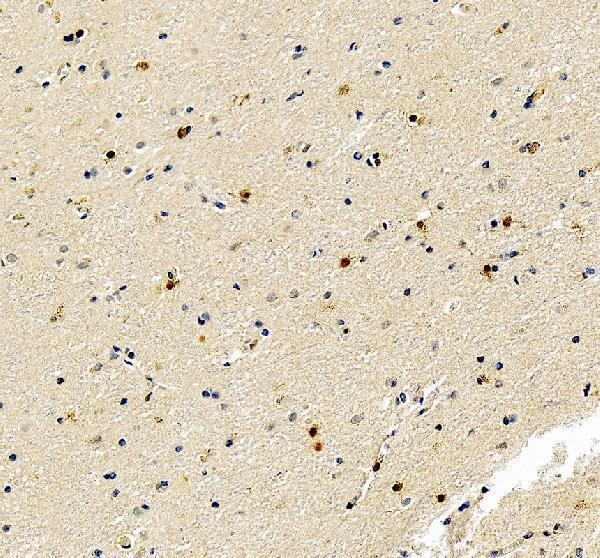 IHC analysis of FGF2 using anti-FGF2 antibody (RP1006)