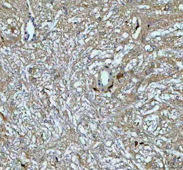  IHC analysis of GH1 using antiGH1 antibody (RP1007)