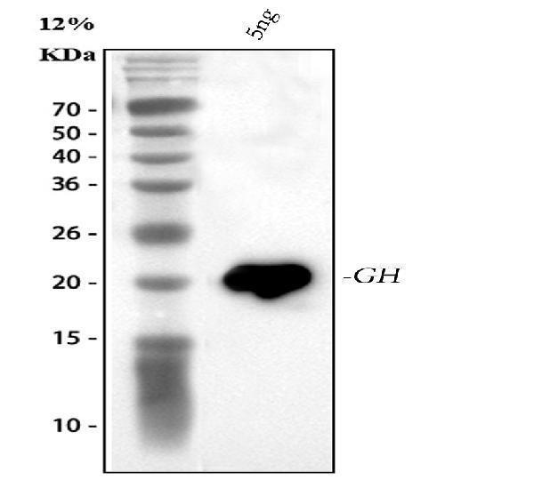  Western blot analysis of GH1 using anti-GH1 antibody (RP1007)