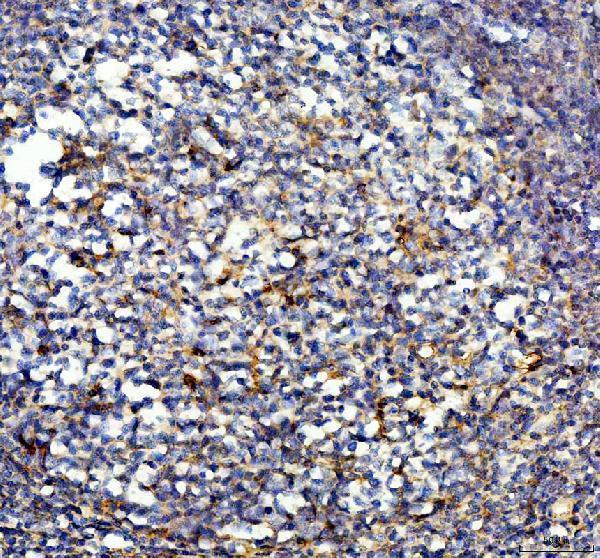 IHC analysis of IL10 using anti-IL10 antibody (RP1014)