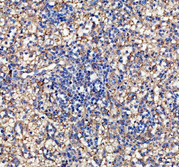 IHC analysis of IL10 using anti-IL10 antibody (RP1014)