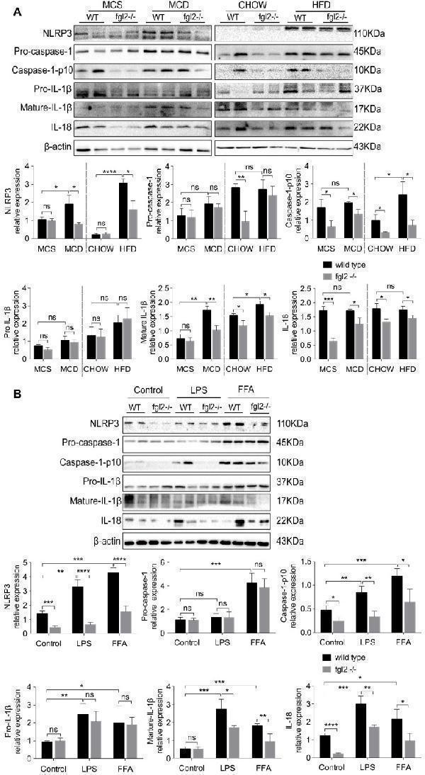 Fgl2 disruption inhibited activation of the NLRP3 inflammasome in NASH