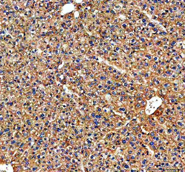 rp1022 tf primary antibodies ihc testing 2_1