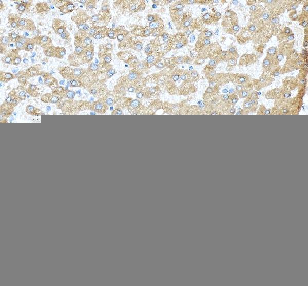 rp1022 tf primary antibodies ihc testing 3