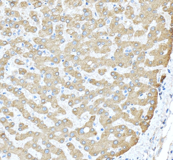 rp1022 tf primary antibodies ihc testing 3_1