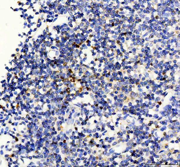 rp1032 foxp3 primary antibodies ihc testing 1