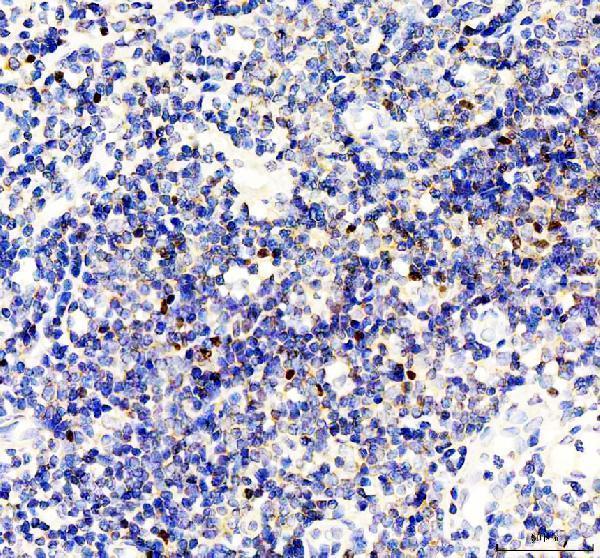rp1032 foxp3 primary antibodies ihc testing 2