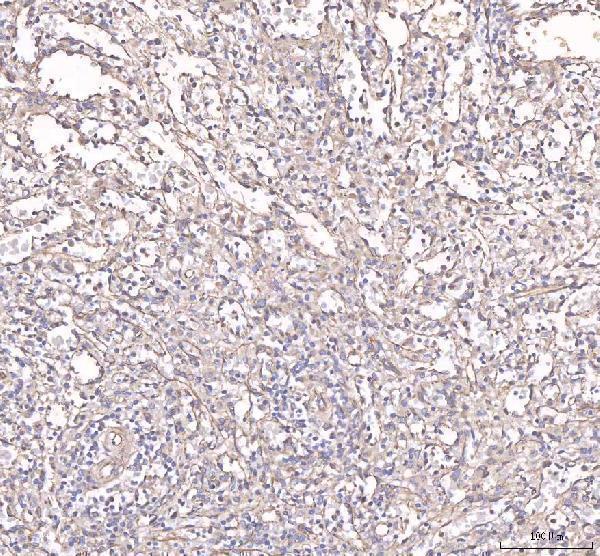 rp1037 angpt2 primary antibodies ihc testing 2