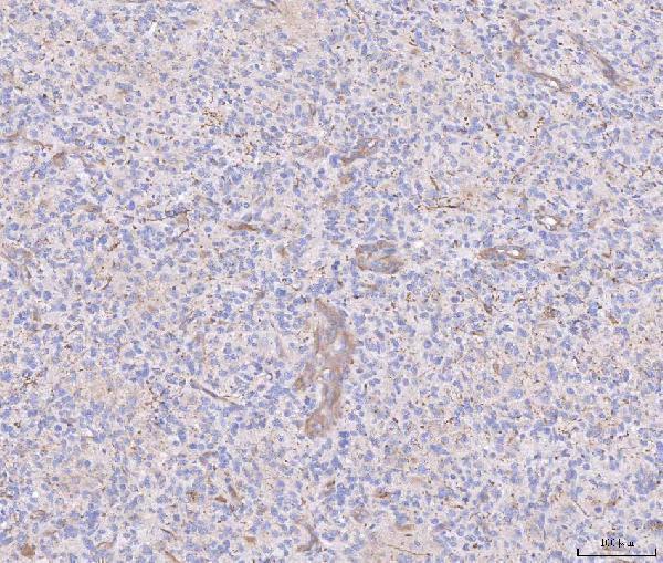 rp1037 angpt2 primary antibodies ihc testing 4