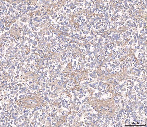 rp1037 angpt2 primary antibodies ihc testing 5