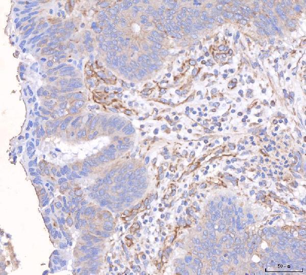 rp1037 angpt2 primary antibodies ihc testing 6