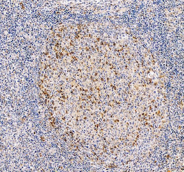  IHC analysis of PD1 using anti-PD1 antibody (RP1039)
