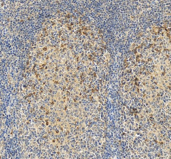 IHC analysis of PD-1/CD279/PDCD1 using anti-PD-1/CD279/PDCD1 antibody (RP1039)