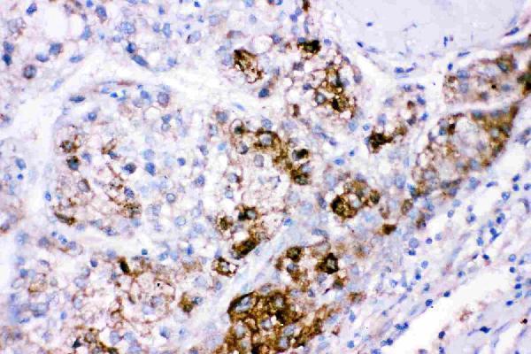  IHC analysis of CBS using anti-CBS antibody (RP1041)