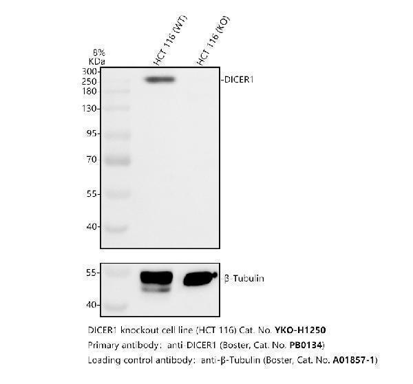 Western blot analysis of DICER1 using anti-DICER1 antibody (RP1044)