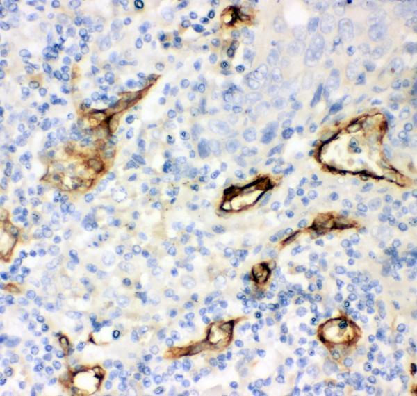 rp1050 3 ihc anti cd146 antibody