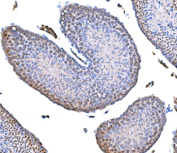 Figure 2. IHC analysis of Survivin using anti-Survivin antibody (RP1052). Survivin was detected in a paraffin-embedded section of mouse testis tissue. Heat mediated antigen retrieval was performed in EDTA buffer (pH 8.0, epitope retrieval solution). The tissue section was blocked with 10% goat serum. The tissue section was then incubated with 2 microg/ml rabbit anti-Survivin Antibody (RP1052) overnight at 4°C. Peroxidase Conjugated Goat Anti-rabbit IgG was used as secondary antibody and incubated for 30 minutes at 37°C. The tissue section was developed using HRP Conjugated Rabbit IgG Super Vision Assay Kit (Catalog # SV0002) with DAB as the chromogen. Figure 2. IHC analysis of Survivin using anti-Survivin antibody (RP1052). Survivin was detected in a paraffin-embedded section of mouse testis tissue. Heat mediated antigen retrieval was performed in EDTA buffer (pH 8.0, epitope retrieval solution). The tissue section was blocked with 10% goat serum. The tissue section was then incubated with 2 microg/ml rabbit anti-Survivin Antibody (RP1052) overnight at 4°C. Peroxidase Conjugated Goat Anti-rabbit IgG was used as secondary antibody and incubated for 30 minutes at 37°C. The tissue section was developed using HRP Conjugated Rabbit IgG Super Vision Assay Kit (Catalog # SV0002) with DAB as the chromogen.