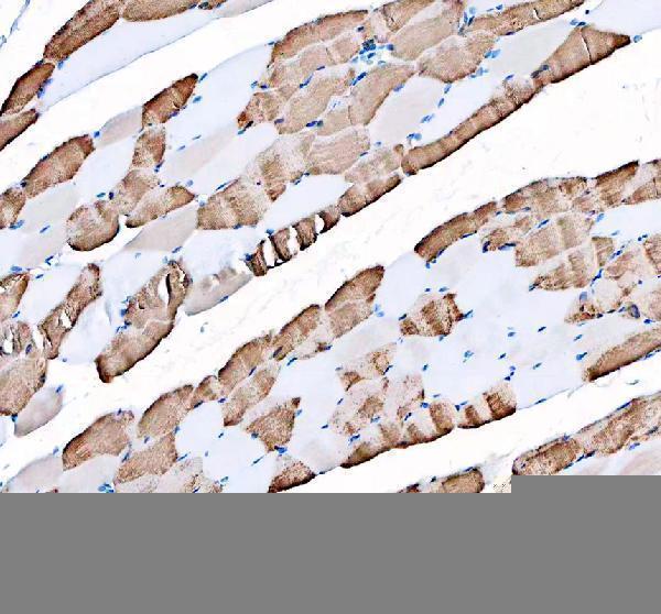 IHC analysis of ATP2A1 using anti-ATP2A1 antibody (RP1053)