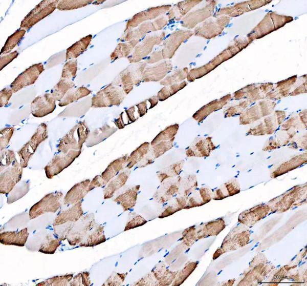 rp1053 atp2a1 primary antibodies ihc testing 1_1