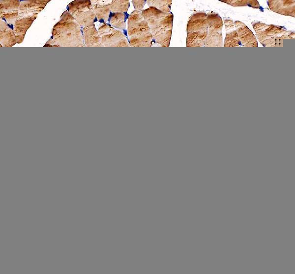 IHC analysis of ATP2A1 using anti-ATP2A1 antibody (RP1053)