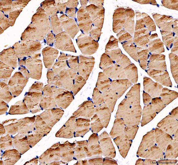 rp1053 atp2a1 primary antibodies ihc testing 2_1