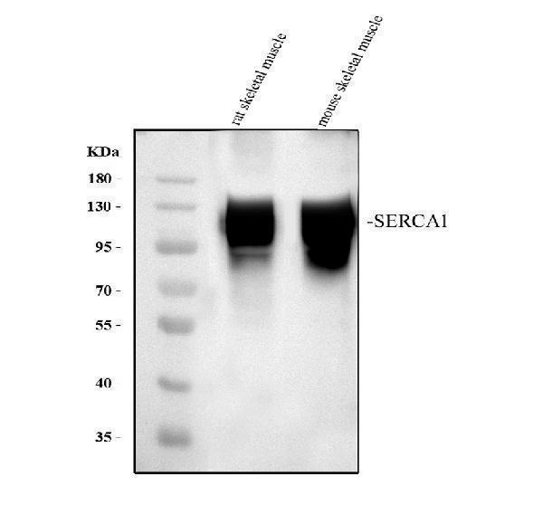 Western blot analysis of ATP2A1 using anti-ATP2A1 antibody (RP1053)