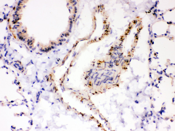 rp1054 2 ihc anti serca2 atpase antibody
