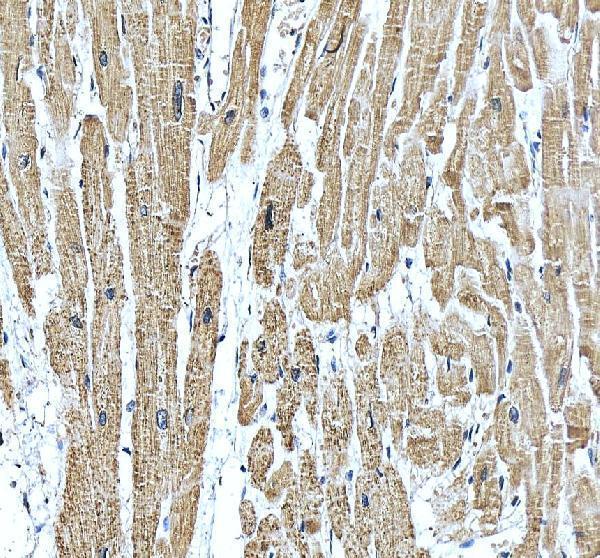 IHC analysis of SERCA2/ATP2A2 using anti-SERCA2/ATP2A2 antibody (RP1054)