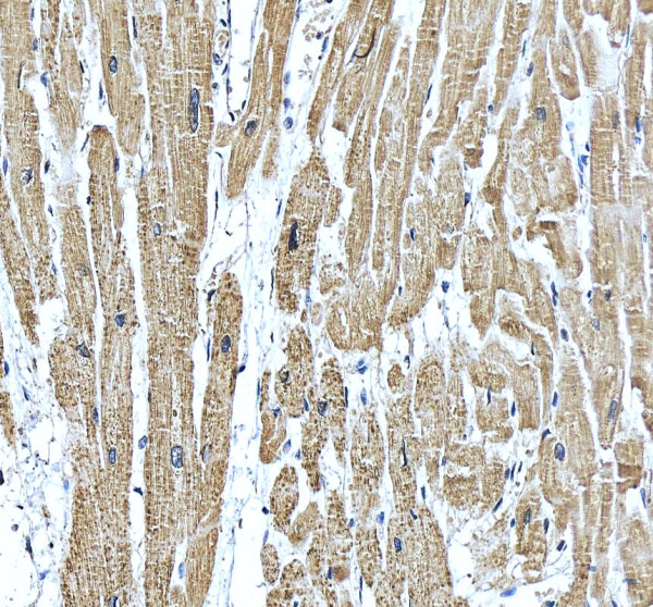 rp1054 atp2a2 primary antibodies ihc testing 4_1