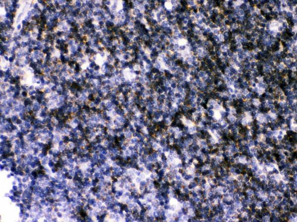 rp1055 3 ihc anti atp2a3 serca3 atpase antibody