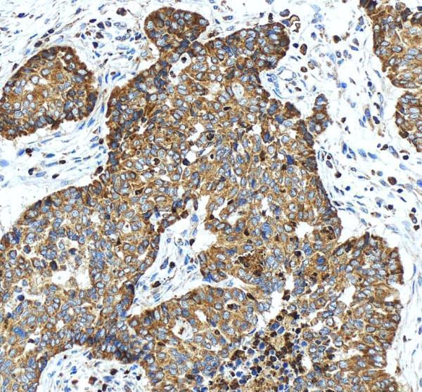 rp1055 atp2a3 primary antibodies ihc testing 4_1