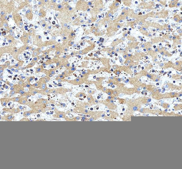 rp1055 atp2a3 primary antibodies ihc testing 5