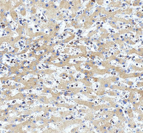 rp1055 atp2a3 primary antibodies ihc testing 5_1