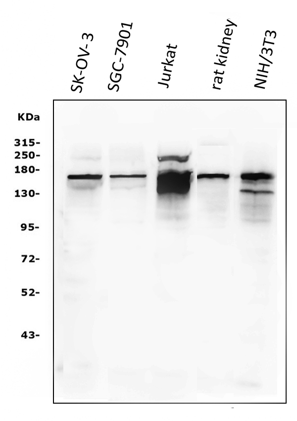 Figure 1. Western blot analysis of KAT13A/SRC1 using anti-KAT13A/SRC1 antibody (RP1056). Electrophoresis was performed on a 5-20% SDS-PAGE gel at 70V (Stacking gel) / 90V (Resolving gel) for 2-3 hours. The sample well of each lane was loaded with 50ug of sample under reducing conditions. Lane 1: SK-OV-3 whole cell lysates, Lane 2: SGC-7901 whole cell lysates, Lane 3: Jurkat whole cell lysates, Lane 4: rat kidney tissue lysates, Lane 5: NIH/3T3 whole cell lysates. After Electrophoresis, proteins were transferred to a Nitrocellulose membrane at 150mA for 50-90 minutes. Blocked the membrane with 5% Non-fat Milk/ TBS for 1.5 hour at RT. The membrane was incubated with rabbit anti-KAT13A/SRC1 antigen affinity purified polyclonal antibody (Catalog # RP1056) at 0.5 microg/mL overnight at 4°C, then washed with TBS-0.1%Tween 3 times with 5 minutes each and probed with a goat anti-rabbit IgG-HRP secondary antibody at a dilution of 1:5000 for 1.5 hour at RT. The signal is developed using an Enhanced Chemiluminescent detection (ECL) kit (Catalog # EK1002) with Tanon 5200 system. A specific band was detected for KAT13A/SRC1 at approximately 157KD. The expected band size for KAT13A/SRC1 is at 157KD.