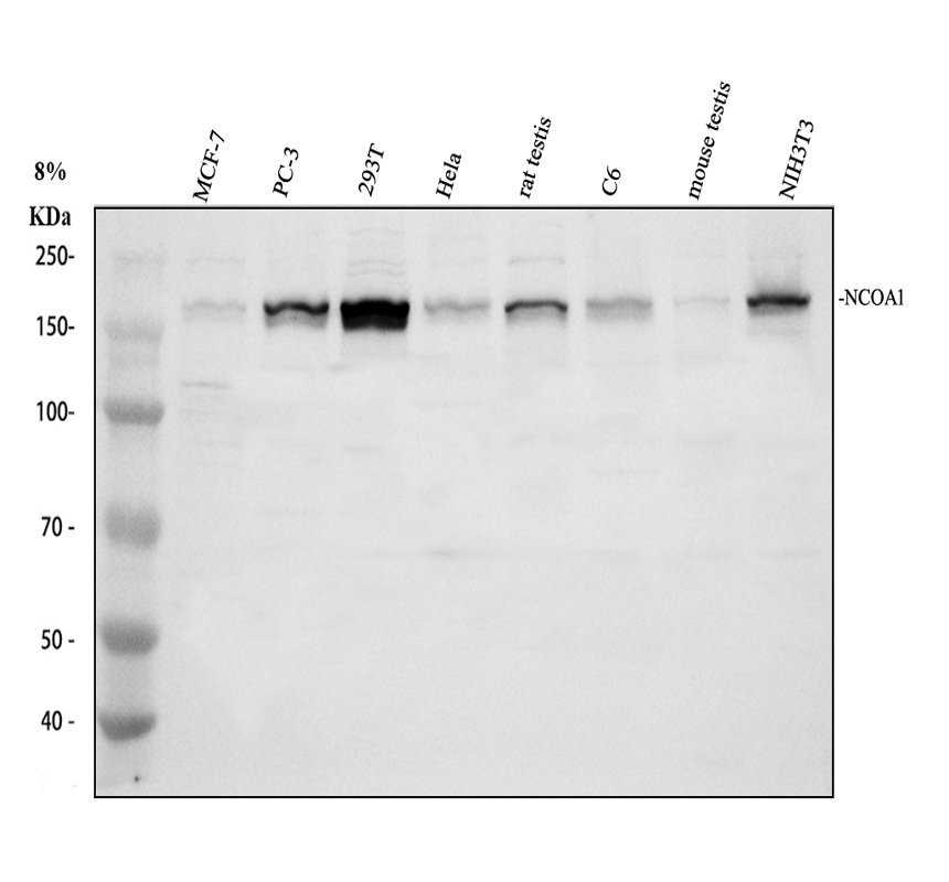 Western blot analysis of KAT13A/SRC1 using anti-KAT13A/SRC1 antibody (RP1056)