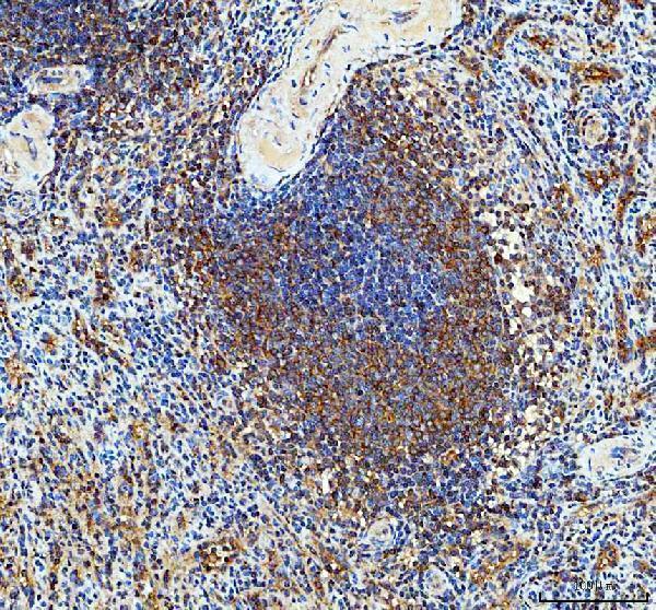 rp1058 prkcd primary antibodies ihc testing 1