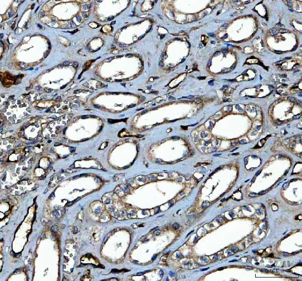 rp1058 prkcd primary antibodies ihc testing 2