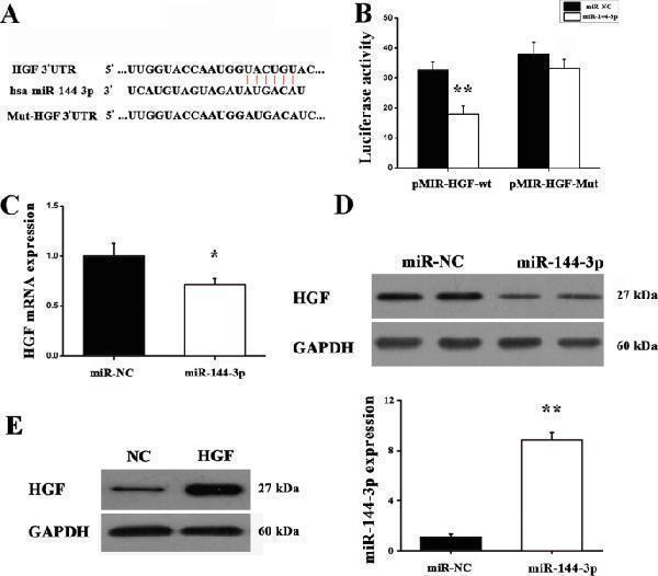 HGF is a direct target of miR-144-3p