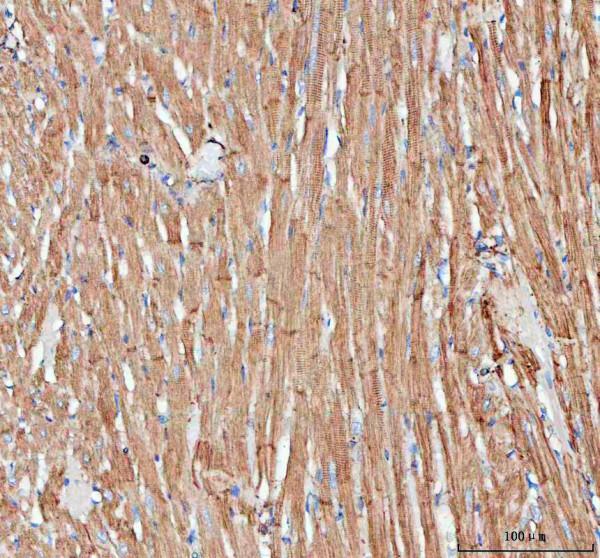 rp1070 actin primary antibodies ihc testing 8_1