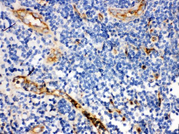 rp1076 1 ihc anti cd59 antibody