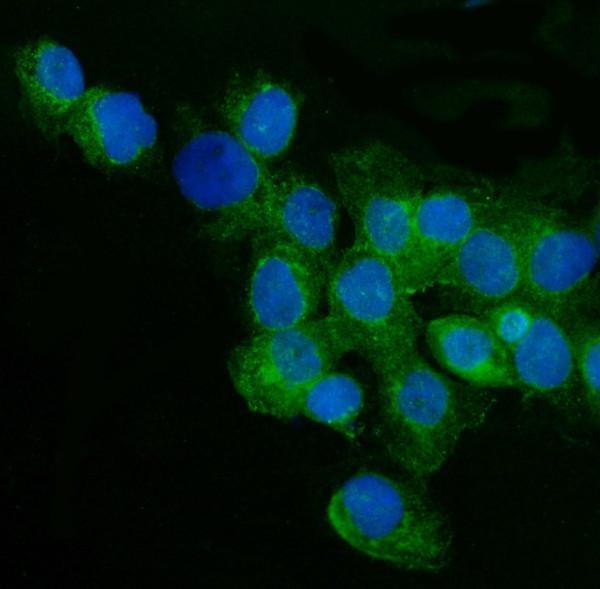 rp1076 cd59 primary antibodies if testing 4_1