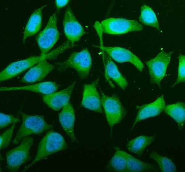 IF analysis of JNK2/MAPK9 using anti-JNK2/MAPK9 antibody (RP1077)
